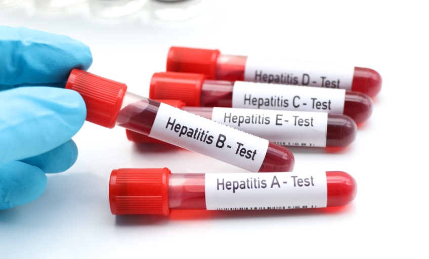 causes of hepatitis_Activ Living Community