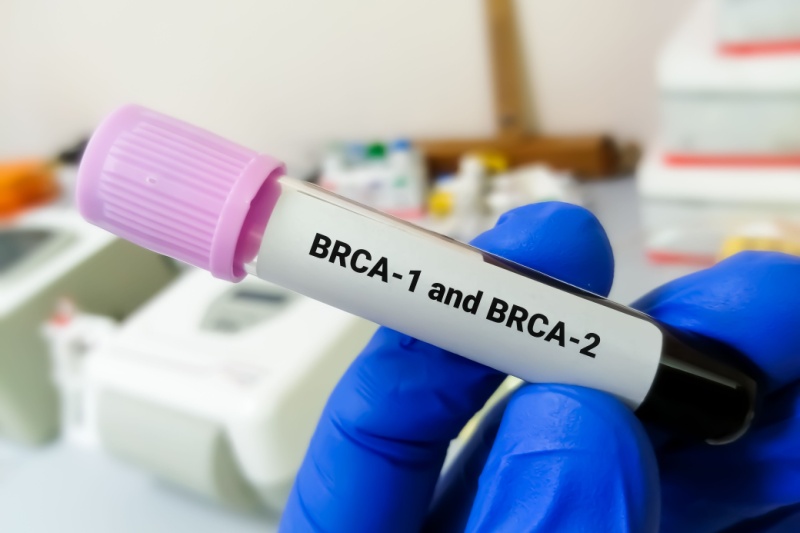 brca 1_Activ Living Community